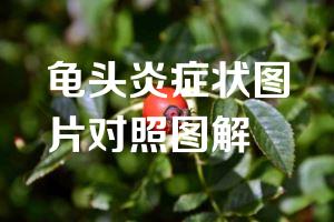 龟头炎症状图片对照图解